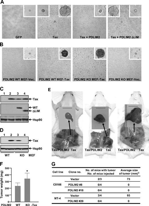 Figure 5. PDLIM2 suppresses tumorigenicity of HTLV-I/Tax both in vitro and in vivo. (A) Rat-1 cells stably expressing GFP, Tax, Tax, and PDLIM2, or Tax and PDLIM2 LIM deletion mutant (ΔLIM) were plated in soft agar for colony formation. Pictures shown here were taken at day 21 after plating. Original magnification: ×100. (B) PDLIM2 wild-type (WT) and knockout (KO) MEFs stably expressing Tax or an empty vector (Vec) were plated in soft agar for colony formation. Pictures shown here were taken at day 21 after plating. Original magnification: ×40. (C) Expression levels of Tax, exogenous PDLIM2 (WT), and LIM deletion mutant (ΔLIM) in Rat-1 stable cells used in panels A and E were examined by IB using Tax and Myc antibodies, respectively. The expression levels of Hsp90 were used as a loading control. (D) Expression levels of Tax in PDLIM2 wild-type or knockout stable cells used in panels B and F were examined by IB using Tax antibody. The expression levels of Hsp90 were used as a loading control. (E) Rat-1 cells stably expressing Tax or Tax/PDLIM2 were subcutaneously inoculated into the right and left hind-back of the same SCID mouse, respectively. Pictures (from left to right) here were taken at days 14, 21, and 28 after inoculation, respectively. Bar represents 1 cm. (F) PDLIM2 WT and KO MEFs stably expressing Tax were subcutaneously inoculated into the right and left hind-back of the same SCID mouse, respectively. The mice were killed at day 21 after inoculation and tumor weights were measured. The data presented are the mean plus or minus standard deviation (n = 15), and P value is .027 (Student t test). (G) The indicated HTLV-I–transformed T-cell lines stably expressing PDLIM2 or an empty vector were subcutaneously inoculated in the postauricular region of SCID mice. The mice were killed at day 21 of postinoculation for tumor evaluation.