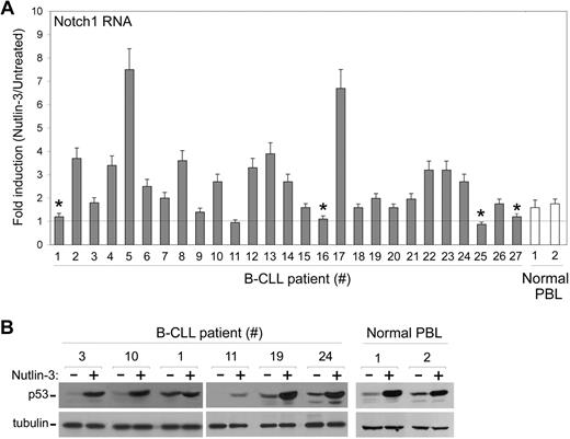 Figure 4. Modulation of Notch1 mRNA by Nutlin-3 in primary B-CLL patient samples. After exposure to Nutlin-3 for 24 hours, samples from B-CLL and from normal PBLs were analyzed for Notch1 mRNA levels (A) and for p53 accumulation (B). (A) Levels of Notch1 mRNA were analyzed by quantitative RT-PCR. After normalization to the level of GAPDH mRNA, results were expressed as fold of Notch1 mRNA induction in Nutlin-3–treated cultures with respect to the control untreated cultures. Data are reported as means ± SD of results from experiments each performed in triplicate. *TP53mutated B-CLL samples. (B) p53 protein levels, analyzed by Western blot, are shown for representative B-CLL and normal PBL samples. Tubulin staining is shown as loading control.