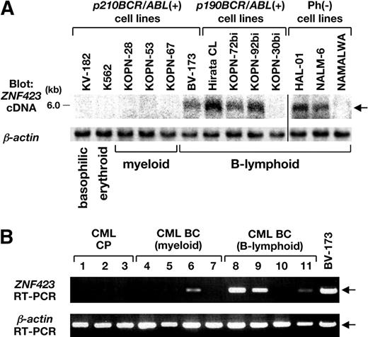 Figure 5. Expression of ZNF423 in BCR/ABL-positive cell lines and in CML BC samples. (A) mRNA (3 μg) extracted from 6 p210BCR/ABL-positive, 4 p190BCR/ABL-positive, and 3 Ph-negative cell lines was blotted with a part of the human ZNF423 coding region. β-Actin hybridization was performed as an internal control. The position of the ZNF423 message is indicated by → and the immunophenotypes of the cell lines are shown at the bottom. A vertical line has been inserted to indicate a repositioned gel lane. (B) Total RNAs extracted BM samples from 3 CML CP and 8 CML BC cases (4 myeloid and 4 B-lymphoid) were subjected to RT-PCR for ZNF423 expression. β-Actin RT-PCR was performed as an internal control.