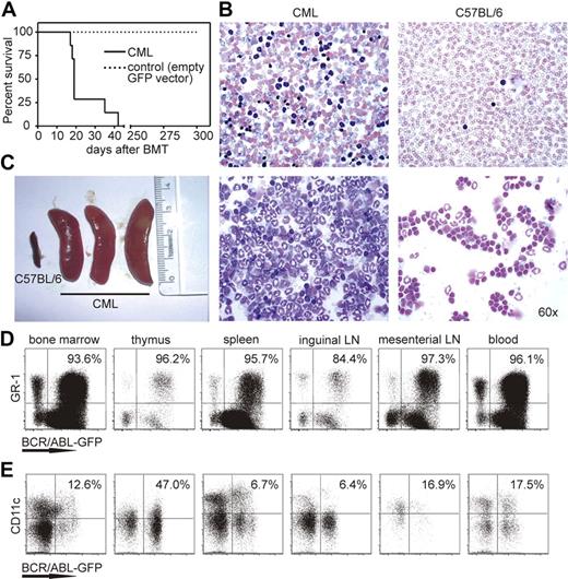 Figure 1. CML model and BCR/ABL-expressing granulocytes and DCs in different organs. (A) Survival of CML (—) and control mice (, empty GFP vector–transduced bone marrow) is shown in Kaplan-Meier plots. (B) Blood smear (top) and cytospin analysis (bottom) of CML mice and naive C57BL/6 mice. One representative Pappenheim staining of 10 is shown (original magnification ×60) included in “Methods.” (C) Spleen size of naive C57BL/6 mice and CML mice. (C,D) Bone marrow, thymus, spleen, inguinal and mesenterial lymph nodes (LN), and blood were isolated from CML mice. Samples were analyzed for the presence of BCR/ABL-GFP–expressing GR-1+ granulocytes (D) and CD11c+ DCs (E) by flow cytometry. Numbers indicate the percentage of BCR/ABL-expressing cells of total GR-1+ or CD11c+ cells. One representative FACS plot of 4 independent experiments is shown.