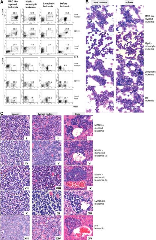 Figure 5. Icsbp−/−Nf1+/− mice develop different types of leukemias; myeloid leukemias are predominant. Leukemias were classified according to diagnostic criteria established by Kogan et al.30 (A) Flow cytometry staining of leukemias: hematologic organs stained with the myeloid (Gr-1, CD11b) and a B-lymphoid marker (B220) showed differences in maturation and cell composition of the different forms of leukemia in comparison to mice without leukemias. MPD-like leukemias showed highest expression of myeloid and low expression of lymphoid markers in BM and spleen, whereas lymphatic leukemias showed little residual myelopoiesis in BM (n = 10, MPD-like myeloid leukemia; n = 5, myelomonocytic leukemia; n = 1, lymphatic leukemia: n = 5, preleukemic mice). (B) Cytomorphology of leukemias: myelomonocytic leukemias displayed a high percentage of myeloblasts with residual myeloid maturation, whereas lymphatic leukemias showed a high percentage of blast cells with little residual myeloid maturation. Mice without disease manifestation were characterized by high neutrophil granulocyte maturation as typical for Icsbp−/− mice (g indicates neutrophil granulocyte; l, lymphocyte; and b, blast). Pictures were taken with an Olympus BX41 microscope, equipped with a 40× UPlanFLN 0.75 objective with eyepiece UIS2 WHN 10×, in air. Slides were stained with hematoxylin and eosin. Electronic pictures were taken with a ColorView II version 2.0 camera (SIS, Münster, Germany). Images were acquired with analySIS docu, version 5.0 (SIS) and used without further processing. (C) Histology of tumor infiltrates. Disease-specific massive organ infiltration in spleen, submandibulary lymph nodes with extensive extramedullary hematopoiesis, and liver with mature and blastic (i-iii) in MPD-like leukemia or predominantly myeloblastic cells in myelomonocytic leukemia (iv-ix) was observed. Lymphatic leukemia showed infiltration with lymphocytes without differentiation pattern and large blasts (x-xii). In several instances, eosinophil crystalloid depositions (Charcot-Leyden crystals) were observed (ii). Organs from Icsbp−/−Nf1+/− mice without disease manifestation showed little infiltration with granulocytes and blasts (xiii-xv). Organs were stained with hematoxylin and eosin. Original magnification ×400. Pictures were taken with a Leica DMRB microscope, equipped with a 100× NPlan 1.25 objective with eyepiece magnification LPlan 10×, in oil. Slides were stained with May-Gruenwald. Electronic pictures were taken with an Insight camera 4.0 (Visitron Diagnostic Instruments, Sterling Heights, MI). Images were acquired and processed with SpotSoftware 4.1. (Visitron Diagnostic Instruments).