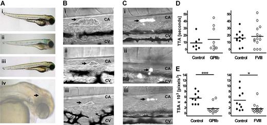 Figure 3. Thrombus formation in GPIIb and FVIII MO-injected fish in a laser-induced arterial injury model. (A) Representative phenotypes of 3 dpf control siblings (i) and fish injected with 2 ng GPIIb MO (itga2b atg1, ii), 4 ng FVIII MO (f8 sp2, iii), or coinjected with both MOs at 2 ng and 8 ng, respectively (iv). An intracranial hemorrhage, as observed in 5% of larvae, is indicated by arrowhead (iv). (B) Representative images of thrombus formation (arrows) 2 minutes after injury in 3-dpf wild-type larvae (i) or larvae injected with 2 ng GPIIb (ii) or 4 ng FVIII MOs (iii). CA indicates caudal artery; CV, caudal vein. White lines represent each thrombus as carried out in ImageJ for determining TSA. (C) Representative images of thrombus formation in 4-dpf CD41-GFP fish controls (i), and siblings injected with 2 ng GPIIb (ii) or 4 ng FVIII (iii) MOs showing thrombocyte-rich thrombi. (D) TTA and (E) TSA (2 minutes after injury) were measured and compared with uninjected sibling controls. Statistical analyses were performed using an unpaired Student t test (*P < .05; ***P < .001).