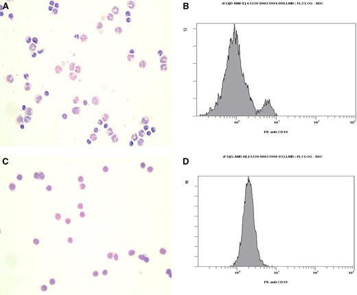 Figure 1. Cells were purified to more than 95% purity as assessed by morphology and flow cytometry. After cell isolation, an aliquot of purified cells was removed and assessed for purity as described. Example of CD19+ B cells isolated from peripheral blood mononuclear cells. (A) Peripheral blood mononuclear cells assessed by Romanovsky-stained cytocentrifuge preparations and (B) phycoerythrin-labeled anti-CD19 by flow cytometry. After purification, more than 98% of cells were CD19+ as assessed by (C) a 1000 differential cell count of Romanovsky-stained cytocentrifuge preparations and (D) flow cytometry. Images and purity levels are representative of all samples processed. (A,C) Romanovsky-stained samples were visualized using an Olympus BX51 microscope (Olympus, Tokyo, Japan) with a 100×/1.30 oil objective and immersion oil (nd 1.516; Olympus). Images were captured using a Pixera Pro600ES and Penguin/Pro Application Suite version 3.0.1 (Pixera, Los Gatos, CA).