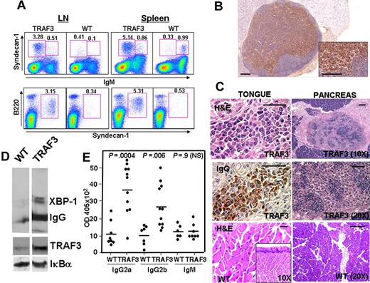 Figure 2. TRAF3 mice develop plasmacytosis. (A) Phenotypic analysis of plasma cells. Submaxillary lymph nodes (LN) and spleen lymphoid populations were analyzed by 3-color flow cytometry in a representative 14-month-old TRAF3 transgenic mouse (TRAF3) and wild-type littermate (WT). Total nucleated cells were stained for B220, Syndecan-1 and IgM surface expression and analyzed with no gate (top) or selecting the IgM null cells (bottom). Numbers indicate the percentage of cells in that gate. (B) Analysis of plasma cells in lymph nodes. Immunohistochemical analysis of a representative lymph node from a diseased TRAF3 mouse showing severe plasmacytosis. Plasma cells were identified by cytosolic Ig staining. Bars, 100 μm. (C) Plasma cell infiltrates in tissues from TRAF3 mice. Immunohistochemical analysis of the tongue (left) and pancreas (right) of a representative diseased TRAF3 mouse (top and middle panels) and a wild-type littermate (bottom panels). Left, H&E (top and bottom) or anti-IgG (middle) staining of sections of the tongue. Right, H&E staining of infiltrating plasma cell in the pancreas. Bars, 50 μm. (D) Analysis of the expression XBP-1 and IgG in purified B cells. B-cell extracts (20 μg) were analyzed by SDS-PAGE and immunoblotting. (E) TRAF3 mice develop hypergammaglobulinemia. Serum IgG2a, IgG2b, and IgM concentrations from TRAF3 mice (ϵ-line) and wild-type littermates (10-15 months old) were determined using isotype-specific ELISA. P values are indicated in the figure. Statistical significance was determined by unpaired Student t test.