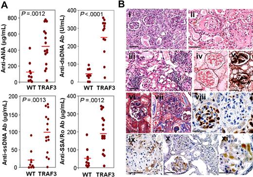 Figure 4. TRAF3 mice develop autoimmunity. (A) Analysis of circulating autoantibodies in TRAF3 mice and wild-type littermates. Blood from TRAF3 mice (12-17 months old) and from wild-type littermates was extracted for serum collection. The presence of autoantibodies in serum was determined by ELISA (anti-dsDNA, 1:150 dilution; anti-ANA, anti-ssDNA, and anti-SSA/Ro, 1:50 dilution). Statistical significance was determined by unpaired Student t test. (B) Pathologic alterations in kidneys from TRAF3 mice. Morphologic lesions encompass both glomerular (i-xi) and tubulointerstitial (i,iii) alterations, demonstrated by H&E (i-iii), Jones silver methanamine (iv,v), and Masson trichrome (vi,vii) stains. Depositions of IgG (viii,ix) and C3 complement (x,xi) were detected by immunostaining. Bars, 50 μm.