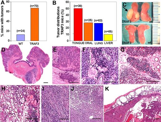 Figure 6. Cancer development in TRAF3 transgenic mice. (A) Percentage of tumors found in wild-type mice (n = 24; 17 ± 1.5 months) and in TRAF3 mice (n = 70; 18 ± 0.8 months). (B) Graphic representation of percentage of mice bearing tumors in the tongue (squamous cell carcinoma, n = 19; papilloma, n = 2), other oral tumors (pleomorphic adenomas, cystadenomas, and adenocarcinomas), lung carcinomas (papillary bronchioloalveolar carcinoma, n = 15; adenoma, n = 2), and hepatocarcinoma (n = 7). (C) Comparative analysis of tongues from 2-month-old (bottom) and 14-month-old (top) TRAF3 mice and wild-type littermates. The arrow indicates the squamous cell carcinoma in the tongue. (D,E) Squamous cell carcinoma of the tongue (H&E). (F,G) Example of lymphoid infiltration in submaxillary gland and parotid gland, respectively, in TRAF3 mice. (H,I) H&E staining of parotid glands with pleomorphic adenoma and sarcoma, respectively. (J) Papillary bronchioloalveolar carcinoma of lung in a TRAF3 mouse. (K) H&E staining of hepatocellular carcinoma in TRAF3 mouse. Note the presence of subcapsular fat necrosis with chronic inflammatory cells. Bars (D-K), 100 μm.
