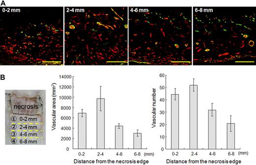Figure 1. New vessel distribution in the skin flap. (A) The vascular distribution in the skin flap was observed in areas at every 2-mm interval from the necrotic edge. CD31 (red) is a marker for ECs, and αSMA (green) is a marker for mural cells. Scale bars are 200 μm. (B) The dashed line indicates the necrotic edge. The vascular area and vascular density per high-power field were determined from every 2-mm interval from the necrotic edge. Data are expressed as the means and SDs of each area.