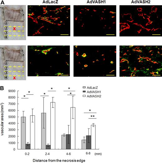 Figure 4. Effects of exogenous VASH1 or VASH2 on angiogenesis in the skin flap. AdVASH1 or AdVASH2 was injected into the tail vein to supply sufficient exogenous proteins to the site of angiogenesis. (A) Immunostaining of CD31 (red) and αSMA (green) positive cells in the indicated area of the skin flap. Scale bars are 50 μm. (B) Vascular area was determined from 5 different fields in each area. Data are expressed as the means and SDs; *P < .01, **P < .05.