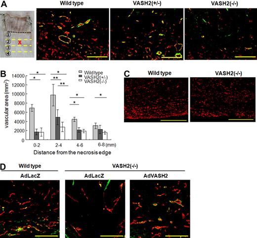 Figure 7. Vascular distribution in the skin flap of VASH2 knockout mice. VASH2 knockout mice were applied to the model of subcutaneous angiogenesis. (A) Immunostaining of CD31 (red) and αSMA (green) in the area 2 to 4 mm from the necrotic edge is shown. Scale bars are 200 μm. (B) The vascular area was determined from 5 different fields in each area. Data are expressed as the means and SDs; *P < .01, **P < .05. (C) Immunostaining of CD11b (red) in the area 0 to 2 mm from the necrotic edge is shown in wild-type and VASH2−/− mice. Scale bars are 200 μm. (D) Adenoviral-mediated gene transfer was performed to supplement the deficient protein in VASH2 knockout mice. AdLacZ was use as the control. Immunostaining of CD31 (red) and αSMA (green) in the indicated area of the skin flap is shown. Scale bars are 200 μm.
