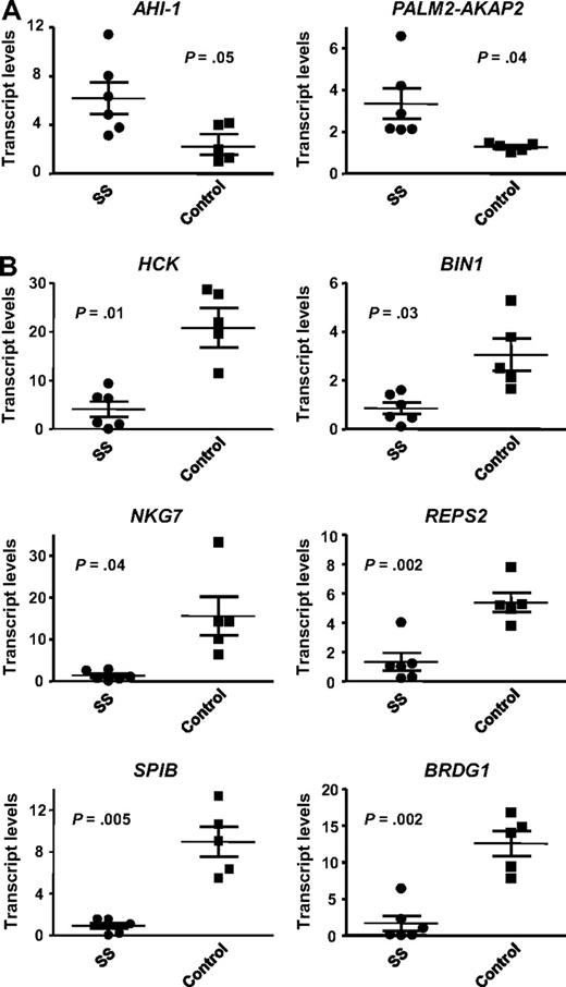 Figure 2. Quantitative RT-PCR validation of 8 differentially expressed genes in CD4+CD7− Sezary cells from SS patients. The expression of several genes identified in the microarray comparing AHI-1–suppressed Hut 78/sh4 cells with Hut 78 control cells were evaluated by quantitative RT-PCR in both CD4+CD7− primary leukemic cells from 6 SS patients and 5 CD4+ normal controls. (A) Validation of up-regulated genes in primary SS samples compared with normal controls: AHI-1 and PALM2-AKAP2. (B) Validation of down-regulated genes in primary SS samples compared with normal controls: HCK, BIN1, NKG7, REPS2, SPIB, and BRDG1. Values shown are the mean ± SEM. The P values presented are the result of 2-sample t tests comparing the SS patient expression data with that of normal controls.