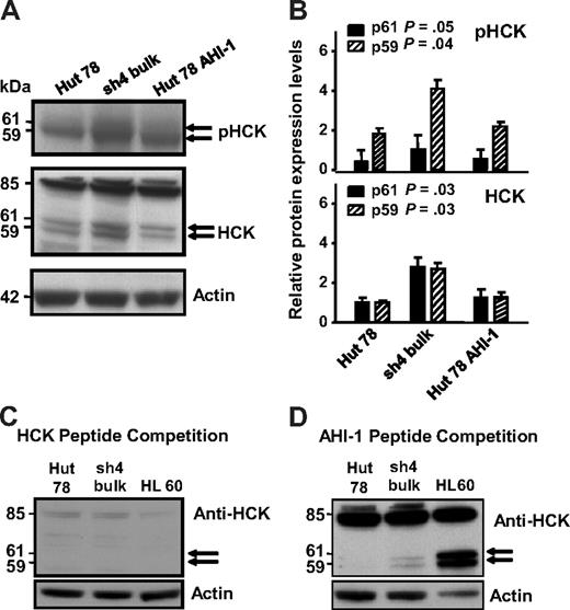 Figure 3. Differential protein expression and phosphorylation of HCK in AHI-1–suppressed and –overexpressed CTCL cells. (A) Up-regulation of 2 isoforms of HCK (p61 and p59) was evident in AHI-1–suppressed Hut 78/sh4 cells compared with the control Hut 78 cells. Reduced HCK protein expression and phosphorylation were observed when AHI-1 was overexpressed in Hut 78 cells. In addition, an uncharacterized 85-kDa band was also observed. (B) Quantification of the differential expression and phosphorylation of HCK for both the p61HCK and p59HCK isoforms relative to actin. (C) Peptide competition experiment in which the HCK primary antibody was incubated with 5-fold of its cognate epitope before use in the Western blot. Dissipation of the doublet bands (p61 and p59) and the uncharacterized 85-kDa band indicated that these results were specific for the HCK antibody. (D) Additional peptide competition experiment in which the HCK antibody was incubated with 5-fold of a random peptide (AHI-1) to show that the previous competition experiment was a direct result of saturation of the HCK antibody. Values shown are the mean ± SEM. The P values presented are the result of 2-sample t tests comparing the expression in cells with AHI-1 suppression with that of Hut 78 controls.