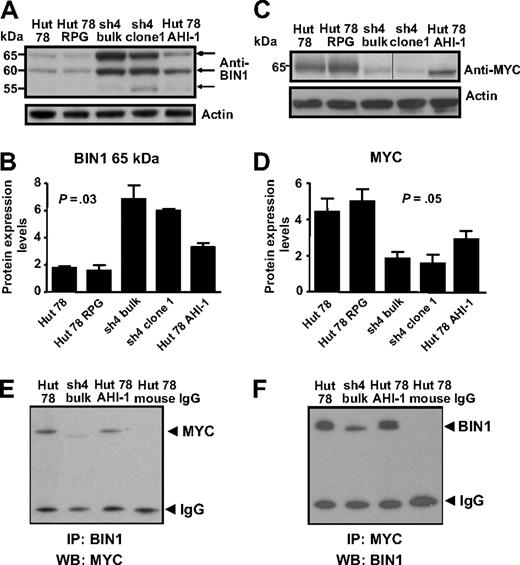Figure 5. Differential protein expression of BIN1 and MYC in AHI-1–suppressed and –overexpressed CTCL cells. (A) Up-regulation of BIN1 was evident in AHI-1–suppressed Hut 78/sh4 cell lines. Of the 3 isoforms detected at 65, 60, and 55 kDa, the most significant up-regulation was observed in the 65- and 60-kDa isoforms. Reduced BIN1 protein expression was also observed when AHI-1 was overexpressed in Hut 78 cells (Hut 78 AHI-1). (B) Quantification of the differential expression of the 65-kDa isoform of BIN1 relative to actin. (C) Changes in MYC expression were observed in AHI-1–suppressed Hut 78/sh4 cell lines and AHI-1–overexpressed cells compared with the control cells (Hut 78 and Hut 78 RPG). Vertical line has been inserted to indicate a repositioned gel lane. (D) Quantification of the differential expression of MYC relative to actin. (E,F) Protein lysates from control Hut 78 cells, AHI-1–suppressed cells (sh4 bulk), and AHI-1–overexpressed cells were used to immunoprecipitate BIN1 (E) and MYC (F), and proteins were detected by Western blotting with antibodies to MYC (E) and BIN1 (F) as indicated. Values shown are the mean plus or minus SEM. The P values presented are the result of 2-sample t tests comparing the AHI-1–suppressed expression data with that of Hut 78 controls.