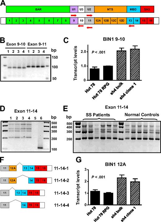 Figure 6. Characterization of BIN1 isoforms in primary and CTCL cells. (A) Schematic diagram of protein domains and exon organization of BIN1 and the specific primers sets generated to detect exons 10, 12A-D, and 13: BIN1 9/10, BIN1 9/11, and BIN1 11/14. BAR indicates BIN1/Amphiphysin/RVS167-related; U, unique; NTS, neural tissue specific; MBD, MYC-binding domain; and SH3, Src homology 3. (B) Yield of both BIN1 9/10 and BIN1 9/11 PCR products by RT-PCR indicates differential splicing of exon 10. Lane 1 indicates Hut 78; lane 2, Hut 78 RPG; lane 3, Hut 78/sh4 bulk; lane 4, Hut 78/sh4 clone 1. (C) Quantitative RT-PCR using the BIN1 9/10 primer set demonstrated up-regulation of BIN1 transcripts containing exon 10 in AHI-1–suppressed cells compared with the control Hut 78 cells. (D) Four distinct RT-PCR products were identified and cloned in Hut 78 cell lines using BIN1 11/14 primers. Lane 1 indicates Hut 78; lane 2, Hut 78 RPG; lane 3, Hut 78/sh4 bulk; lane 4, Hut 78/sh4 clone 1; lane 5, negative control (no RNA); lane 6, positive control (Hut 78 RPG with GAPDH primer set). (E) RT-PCR revealed that the 4 BIN1 11/14 RT-PCR products identified in the Hut 78-transduced cells were also present in both CD4+CD7− SS patients samples and in normal controls. (F) Schematic diagram of the differential splicing of exons 12A and 13 characterized in both the Hut 78 cell lines and primary samples. (G) Quantitative RT-PCR using a BIN1 12A primer set demonstrated up-regulation of BIN1 transcripts containing exon 12A in AHI-1–suppressed cells compared with the control Hut 78 cells. Values shown are the mean plus or minus SEM. The P values presented are the result of 2-sample t tests comparing the AHI-1–suppressed expression data to that of Hut 78 controls.