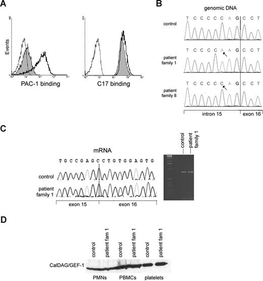 Figure 2. Lack of GPIIbIIIa (αIIbβ3) activation on platelets in the presence of normal CalDAG-GEF1 levels in the LAD1v syndrome. (A) PAC-1 binding to activated αIIbβ3 integrins as detected by flow cytometry (left panel) shows strongly decreased binding to patient platelets after thrombin stimulation (shaded histogram) compared with control platelets (open histogram, solid black line). The binding of CD61 antibody to measure total αIIbβ3 expression, as measured in parallel samples, is shown in the right panel. In both panels, the binding of negative mouse Ig-FITC to the stimulated patient platelets (thin black line) is shown for comparison. The slight shift observed with PAC-1 in the patient platelets was not observed without thrombin stimulation (not shown). (B) A homozygous sequence variant of CALDAGGEF1 in intron 15 is present in the patient. (C) The intronic gene variation results in normal splicing of mRNA. Both reverse-transcribed PCR and sequence analysis of control and patient cDNA that contains exons 12 to 18 gave the expected wild-type products of 802 bp, as shown here. The arrow in the sequence traces indicates the exon 15–exon 16 boundary. (D) Normal CalDAG-GEF1 protein expression on Western blotting at the expected relative molecular mass of approximately 75 kDa is found. Results are representative for 5 of the patients from families 1 through 7 tested in total.
