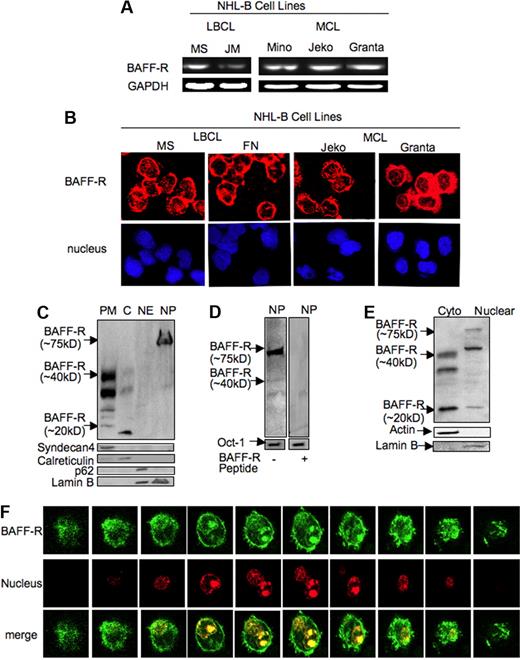 Figure 1. BAFF-R is present in different subcellular compartments in NHL-B cells. (A) RT-PCR analysis of BAFF-R mRNA expression in NHL-B-cell lines. (B) BAFF-R protein was stained for Cy3 (red) fluorescence and a nuclear marker TOPRO-3 (blue) in LBCL and MCL cell lines, and then analyzed by confocal microscopic analysis. (C) Western blot analysis (WB) of protein extract from different subcellular fractions (PM indicates plasma membrane; C, cytoplasm; NE, nuclear envelope; and NP, nucleoplasm) for BAFF-R, syndecan 4 (a plasma membrane marker), calreticulin (an endoplasmic reticulum marker), p62 (a nuclear envelope marker), and lamin B (a nuclear marker). (D) BAFF-R competition experiments were performed by preincubating a BAFF-R peptide with specific BAFF-R antibody before probing nuclear extracts from NHL-B cells. (E) Western blot analysis of 50 μg protein from cytoplasm and nucleoplasm for BAFF-R in normal peripheral blood B cells. Actin and lamin B were used as cytoplasmic and nucleoplasmic markers. (F) Confocal fluorescence microscopic images of GFP-BAFF-R fusion protein localization in a representative live NHL-B cell (MS), cotransfected with BAFF-R expression plasmid pcGFP-BAFF-R (green) and a nuclear localization expression plasmid pDsRed2-Nuc (red).