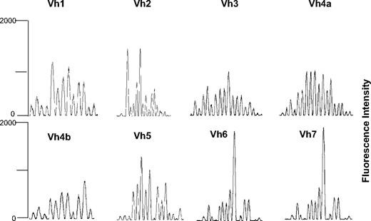 Figure 4. Representative spectratyping of IgH CDR3 in a patient affected by multiple myeloma at day 360 after haploidentical SCT.