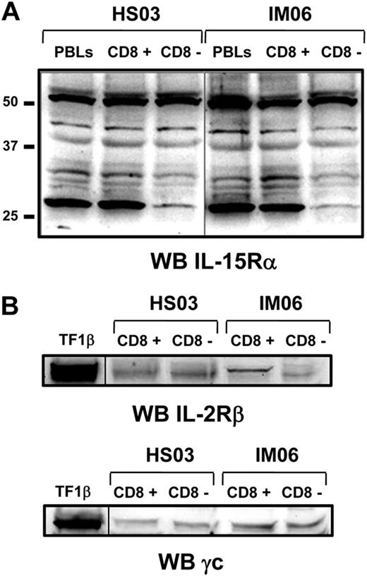 Figure 2. Expression of IL-15R on purified CD8+ and CD8− T-cell fractions by Western blotting. (A) Expression of IL-15Rα isoforms was analyzed on purified CD8+ and CD8− T-cell fractions from IM06 and HS03 subjects using the mAb147 (R&D Systems). Similar results were obtained with the antibody of sc-9172 (Santa Cruz Biotechnology, data not shown). (B) Expression of IL-2/15Rβ and γc was analyzed on both cell subpopulations. Similar results were obtained from different subjects in each group. A vertical line has been inserted to indicate a repositioned gel lane.