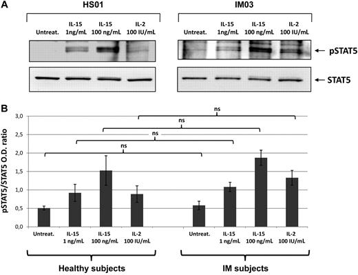 Figure 3. IL-15- and IL-2-induced STAT5 phosphorylation. (A) T cells from IM03 and HS01 were either untreated (untreat.) or stimulated with recombinant IL-15 (1 or 100 ng/mL) or IL-2 (100 IU/mL) for 30 minutes at 37°C. After stimulation, cells were lysed and phosphorylated STAT5a/b was detected by blotting the lysates with an antibody recognizing the STAT5a/b phosphorylated form (p-STAT5). Equivalent amounts of protein in the lysates were confirmed by blotting with anti-STAT5a/b (STAT5). (B) Means of pSTAT5/STAT5 ratio were obtained from 3 IM subjects (IM03, IM04, IM05) and 3 healthy subjects (HS01, HS02, HS05). Statistical analysis was performed using the Student t test and shows no significant differences between IM subjects and healthy subjects, independently of the stimuli used. NS indicates not significant.
