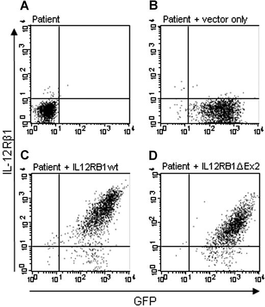 Figure 1. IL-12Rβ1 lacking exon 2 is expressed on the membrane. Expression of IL-12Rβ1 on the cell membrane of activated T cells from an IL-12Rβ1−/− patient was analyzed with the antibody DU-1. (A) Untransduced cells. (B) Cells transduced with GFP vector only. (C) Cells transduced with a wild-type IL12RB1 construct. (D) Cells transduced with the IL12RB1 construct lacking exon 2.