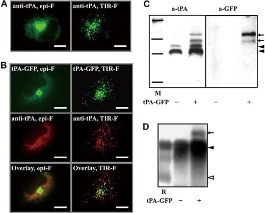 Figure 1. Properties of tPA-GFP expressed in EA.hy926 cells. Intracellular localization of intrinsic tPA (A) and forcibly expressed tPA-GFP (B) in confluent EA.hy926 cells analyzed by immunofluorescence staining and represented by both epifluorescence (epi-F) and total internal reflection-fluorescence (TIR-F) images. (A) Intrinsically expressed tPA molecules in EA.hy926 cells detected by anti-tPA antibody together with Alexa Fluor 488–labeled anti-IgG. (B) tPA-GFP (top panels) and tPA-related proteins detected by anti-tPA antibody together with TRITC-labeled anti-IgG (middle panels). The bottom panels are the merged images of the top and middle panels. The bars represent 10 μm. (C) Western blotting of 24-hour culture media from untransfected cells or transfected with tPA-GFP expression vector. Protein bands were detected by either anti-tPA or anti-GFP antibody. (D) The same samples in panel C were also analyzed by plasminogen-rich fibrin autography. M indicates molecular weight markers for 201, 120, 100, and 56 kD; R, a mixture of recombinant tPA and recombinant PAI-1; ◀, tPA-PAI-1 complexes; and ◁, free tPA. Extra-high-molecular-weight bands in culture medium from tPA-GFP–expressing cells () were detected by both anti-tPA and anti-GFP antibodies, and developed lytic bands in fibrin autography.