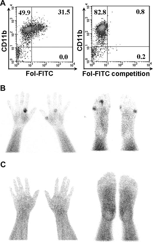 Figure 6. FR expressed on activated macrophages in patients with rheumatoid arthritis can be exploited to deliver folate-conjugated imaging agents to inflamed joints. (A) Synovial cells from 4 patients with rheumatoid arthritis were labeled with anti-CD11b to stain human macrophages and then incubated with folate-FITC in the absence (left panel) and presence (right panel) of 100-fold excess free folic acid before examination by flow cytometry. A representative flow plot is shown here. (B) Radioimage of the hands (left) and feet (right) of a patient with active rheumatoid arthritis, showing sites of uptake of EC20, a folate-targeted 99mTc-based radioimaging agent, in multiple joints of the hands and feet. (C) Radio-image with EC20 of the hands (left) and feet (right) of a nonarthritic patient obtained under identical conditions to those shown in panel B.