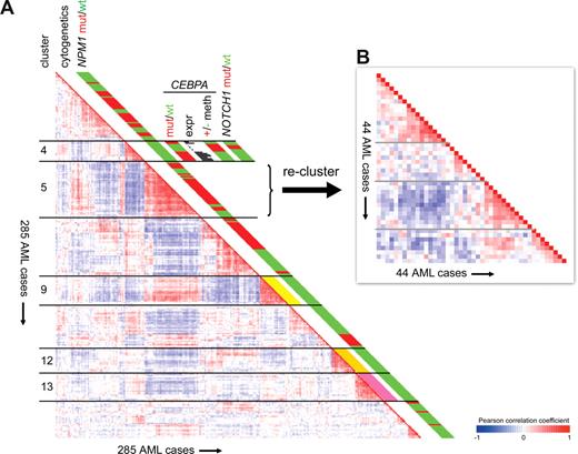 Figure 1. Summary of GEP findings in a cohort of 285 cases of AML. (A) A previous study of 285 cases of AML revealed 16 subgroups (clusters) of cases based on similarities in gene expression profiles.22 Pairwise correlations between these AML cases are shown on the left. The cells in the visualization are colored by Pearson correlation coefficient values, with deeper colors depicting higher positive (red) or negative (blue) correlations, as indicated by the scale bar. Five of the 16 clusters have been labeled as clusters 4, 5, 9, 12, and 13. One finding of the original study was the tight aggregation into distinct clusters of AML cases with cytogenetic abnormalities that predict good risk. For those cases, cytogenetic status is color-coded in the cytogenetics column: inv(16) is yellow, next to cluster 9; t(15;17) is orange, next to cluster 12; and t(8;21) is pink, next to cluster 13. A subsequent study in the same patient cohort identified NPM1 mutations in 95 of 285 cases. NPM1 mutational status is depicted next to each case (red indicates NPM1 mutant; green, NPM1 wild-type).24 The figure illustrates that NPM1 mutations were not randomly distributed over the 16 previously defined clusters, but enriched in several of them. Cluster 4 was found to associate with CEBPA mutations (red indicates CEBPA mutant). However, a subset of 6 patients in this cluster did not show any CEBPA mutation (green indicates CEBPA wild-type). It was found that these cases differed in their CEBPA mRNA expression as compared with the CEBPA mutant AMLs, as indicated by the histograms depicting signal intensity values for the CEBPA probe set on the microarray. In fact, whereas CEBPA mutant AMLs highly expressed CEBPA mRNA, expression was silenced in the cases lacking mutations. This silencing was associated with CEBPA DNA promoter hypermethylation (red indicates methylation; green, no methylation). In addition, NOTCH1 mutations were found as common characteristics of this subgroup (red indicates NOTCH1 mutation; green, NOTCH1 wild-type).31 (B) In the original analysis of 285 AML cases (panel A left), the 44 cases in cluster 5 aggregated very tightly, as indicated by the deep red colors representing positive Pearson correlation coefficients. Most of these 44 cases showed a monocytoid morphology (FAB-M4 or -M5).22 This raises the possibility that a significant part of the clustering effect was caused by specific up- or down-regulation of genes that are important in monocytic differentiation, resulting in a different signature than the remaining, mostly nonmonocytoid, cases of AML in the study. To answer whether gene expression profiling would enable identification of potential heterogeneity within this apparently homogeneous subgroup, in panel B the 44 cases were reclustered as an isolated cohort. For this analysis, only probe sets that showed a variable expression within these 44 AML cases were taken into account, as defined by a fold change of 3.5 to the mean in log2 scale in at least 1 case. The resulting cluster image shows that several potentially interesting subgroups can indeed be identified within these 44 AML cases, which have been indicated by gray lines.