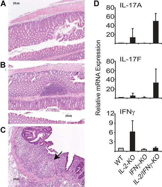 Figure 3. Colitis development in IL-2/IFN-γ–KO mice. Hematoxylin and eosin stains of the descending colon from 27-day-old IL-2–KO (A) and IFN-γ–KO (B) mice, and a 72-day-old IL-2/IFN-γ–KO (C) mouse with a prolapsed rectum. Arrow indicates area of ulceration and underlying inflammation. (D) Cytokine RNAs were examined in the descending colon by real-time PCR. Data were normalized to HPRT and WT was set to 1.