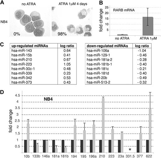 Figure 1. miRNA profiles of NB4 cell line upon ATRA treatment. (A) Morphology of May-Grünwald-Giemsa (MGG)–stained NB4 cells treated or not with ATRA (1 μM) for 4 days. Maturation was monitored by the Nitroblue Tetrazolium (NBT) dye reduction assay and the percentage of NBT-positive cells obtained at day 4 of treatment is indicated (bottom left). (B-D) NB4 cells were treated with 1 μM ATRA for 16 hours. (B) RT-qPCR analysis of RARB mRNA expression in NB4 cells upon ATRA treatment. Results are indicated as fold change, 1 being the cycle threshold (Ct) obtained in the absence of treatment. (C) Table of miRNAs modulated by ATRA. See “Methods.” (D) miRNA-specific RT-qPCRs performed in untreated (black histograms) and ATRA-treated NB4 cells (gray histograms). The asterisk (*) indicates an absence of amplification. Results are indicated as fold change, 1 being the value obtained in the absence of treatment.