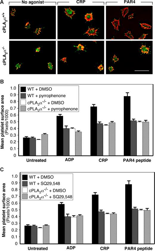 Figure 4. Role of cPLA2α in platelet spreading on fibrinogen. Washed platelets were allowed to adhere to fibrinogen-coated slides for 30 minutes at 37°C in the presence or absence of 20 μM of ADP, 10 μg/mL of CRP, or 1 mM of PAR4 receptor-activating peptide. (A) Platelets were stained with anti-pTyr antibody (green) and rhodamine-phalloidin (red). Images were captured on a deconvolution microscope equipped with a 100× objective. Each panel is representative of 3 separate experiments. Bar represents 10 μm. (B) Pyrrophenone was used at a concentration of 50 μM. (C) SQ29 548 was used at a concentration of 10 μM. In panels B and C, platelets were stained with anti-β3 antibody and rhodamine-phalloidin. Images were captured on an Olympus T-2000 microscope, and platelet surface areas were quantified by computerized image analysis. Data are mean plus or minus SEM of at least 100 platelets per treatment condition.