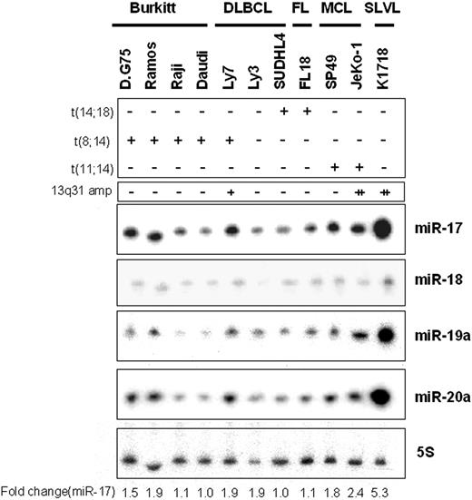Figure 1. Expression of miR-17-92 polycistron in various B-cell lymphoma cell lines. Northern blot analysis for 11 B-cell lymphoma cell lines, including DLBCL (3 samples), follicular lymphoma (FL; 1 sample), Burkitt lymphoma (4 samples), mantle cell lymphoma (MCL; 2 samples), and SLVL (1 sample). Fold changes in miR-17 expression are shown below the gels and adjusted to the level in SUDHL4 cells, which was assigned a value of 1.00. The presence or absence of translocations of BCL2, c-MYC, and/or CCND1/CyclinD1 is indicated in the top panel: + indicates positive; −, negative. Copy number counts for 13q31 amplification (13q31 amp) are indicated immediately above the gels: − indicates less than 2; +, 3 or more to less than 10; and ++, 10 or more.