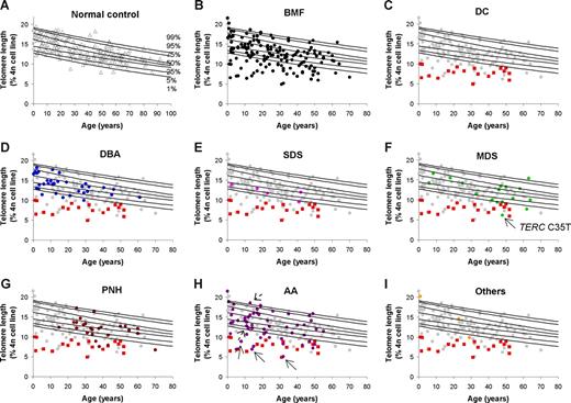 Figure 2. Telomere lengths in PBMC from patients with BMF. Telomere lengths in PBMC were measured by flow cytometric fluorescence in situ hybridization. (A) Telomere length in 234 healthy control subjects between the ages of 1 day and 94 years. The 1st, 5th, 25th, 50th, 75th, 95th, 99th percentiles of healthy controls are shown. (B) Telomere length in 160 patients with BMF from whom telomere measurements were obtained. (C) Telomere length in patients enrolled in the study with the diagnosis of DC. The red squares highlight patients with DC, while gray circles represent the remaining patients with BMF. (D) Telomere lengths in patients with DBA (highlighted in blue). (E) Telomere length in patients with SDS (highlighted in pink). (F) Telomere length in patients with MDS (highlighted in green). Arrows indicate patients in whom a pathogenic C35T TERC gene mutation was identified. (G) Telomere length in patients with PNH (highlighted in brown). (H) Telomere length in patients with aplastic anemia not otherwise classified (AA, highlighted in purple). Arrows indicate patients in whom a pathogenic TERT gene mutation was identified (from left to right; Y846C/H876Q, A716V, A716V). Stippled arrows indicate patients with the variant H412Y. (I) Telomere length in patients with other forms of IBMFS (Pearson syndrome, Fanconi anemia, and FPD, from left to right, highlighted in gold).