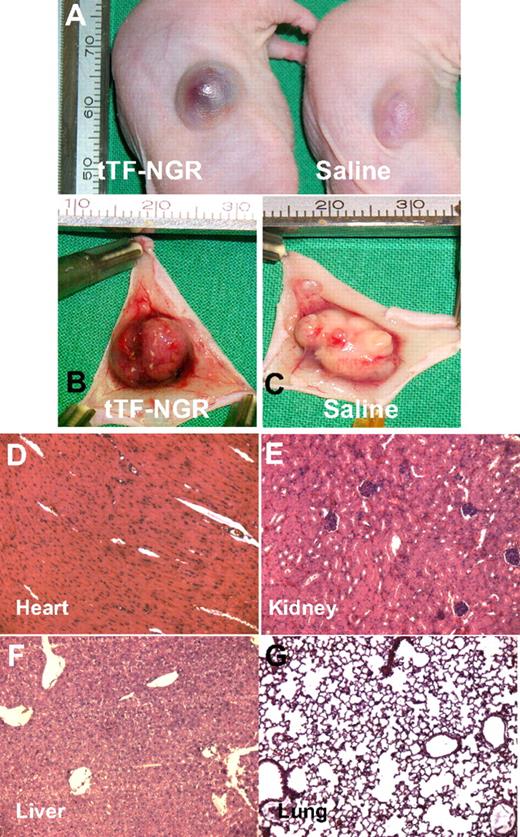 Figure 5. Representative photographs of the malignant melanoma-bearing mice and H&E staining of normal tissue of the tTF-NGR–treated mice. (A) Mice are shown 20 minutes after injection of tTF-NGR (left) and saline (right). The tumor treated with tTF-NGR was bruised and blackened, indicating blood pooling due to vascular disruption. (B) The resected tumor treated with tTF-NGR exhibited areas of hemorrhage in contrast to the vital appearance of the tumor treated with saline (C). Heart (D), kidney (E), liver (F), and lung (G) of the tTF-NGR–treated tumor-bearing mice showed no visible thrombosis. Original magnification, ×200.