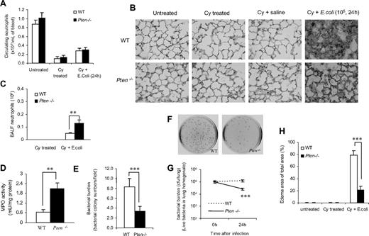 Figure 4. Disruption of PTEN enhances pulmonary neutrophil accumulation and reduces bacterial burden in neutropenia-related pneumonia. (A) PTEN depletion does not affect the amount of circulating neutrophils. The complete blood count (CBC) and white blood cell count of each sample were analyzed using a Hemavet 850 hematology system. (B) Histologic analysis of lungs reveals bacterial colonies and polymerized fibrin in the pulmonary parenchyma. Lungs were fixed with Bouin solution, and 6-μm sections were stained with H&E. (C) Total numbers of neutrophils in BALF were quantified as described in Figure 1A. (D) MPO activity, an indicator of tissue neutrophil accumulation, was determined using an EnzChek MPO activity assay kit (Invitrogen, Carlsbad, CA). (E) Bacterial colonies in histologic lung sections were quantified and expressed as colony numbers in each ×400 field. (F,G) Bacterial killing in inflamed lungs. Live bacteria in lung homogenates were assessed with the colony assay as described in Figure 3B,C. (H) Pulmonary edema formation was quantified as the percentage of edema in the total parenchymal region using IPlab imaging software. All data are presented as mean (± SD; n ≥ 4 mice in each group). **P < .01, ***P < .001 versus WT.