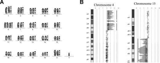 Figure 4. Leukemic cells have acquired genetic abnormalities. (A) Mouse GTG-banded karyotype of ME7a leukemic cells. Chromosomes are arranged alongside their corresponding ideograms (original magnification ×1000). (B) Comparative genomic hybridization of ME4 and ME4b DNA samples. The increase in copy number of a region of chromosome 4 (left panel) and decrease in copy number of a region of chromosome 15 (right panel) detected in ME4b leukemic cells compared with ME4 immortalized cells. Each point on the graph represents the log2 ratio value of a single oligonucleotide probe. The shaded area and vertical line represent an aberrant region identified by the Z-score algorithm (CGH Analytics version 3.4; Agilent Technologies).