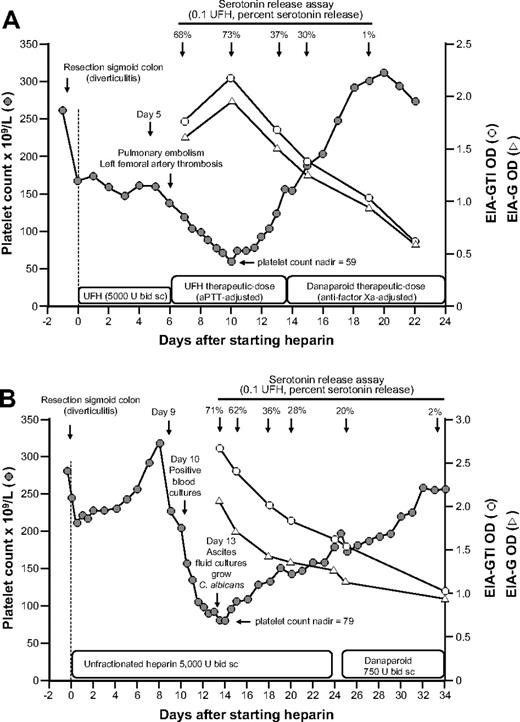 Figure 4. Clinical course, platelet counts, and anti-PF4/heparin antibody reactivity in the EIA and the SRA of 2 patients with prolonged heparin application despite clinical HIT. (A) A 74-year-old man developed thrombocytopenia, pulmonary embolism, and left femoral artery thrombosis on day 6 of postoperative UFH thromboprophylaxis. Despite increased (therapeutic) heparin dosing, the platelet count recovered from 59 × 109/L (nadir, day 10) to 155 × 109/L (day 13). On day 13, the positive SRA test result became available, and heparin was replaced by danaparoid. (B) An 81-year-old woman developed thrombocytopenia beginning on day 9 of postoperative UFH thromboprophylaxis after perforated sigmoid colon resection. Blood cultures on day 10 were positive for Enterococcus faecium, and the platelet count decline was considered to be related to “line sepsis.” Despite continued UFH thromboprophylaxis, the platelet count recovered from 79 × 109/L (nadir) to 157 × 109/L (day 23). On day 23, the positive SRA test result became available, and UFH was replaced by danaparoid.
