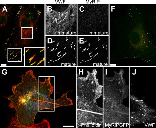 Figure 2. The Rab27a effector MyRIP is present on more mature WPBs. (A) Confocal images acquired of immunofluorescence staining of MyRIP (green), and VWF (red) inset magnified image of polarized localization of MyRIP. Boxed images show magnified images of VWF expression (B,D) and MyRIP (C,E) in immature (B,C) and more mature WPBs (D,E). (F) HUVECs were transfected with MyRIP-GFP, and a maximum intensity projection was made of confocal images acquired of a cell expressing low levels of MyRIP-GFP and VWF (red). (G-J) HUVECs were transfected with MyRIP-GFP, and a maximum intensity projection was made of confocal images acquired of a cell expressing high levels of MyRIP-GFP and VWF (blue) alongside rhodamine-conjugated phalloidin (red). Boxed square shows magnified images of phalloidin (H), MyRIP-GFP (I), and VWF (J). Scale bars represent 10 μm.