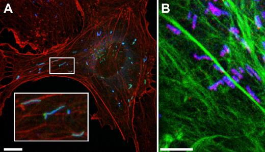 Figure 3. WPBs are often found alongside actin filaments, and some appear to be attached at only one end. (A) HUVECs were transfected with Rab27a-GFP, and a maximum intensity projection was made of confocal images acquired of a cell expressing Rab27a-GFP, VWF (blue), and rhodamine-conjugated phalloidin (red). (B) Maximum intensity projection of confocal images of a HUVECs labeled with MyRIP (red), VWF (blue), and phalloidin Alexa 488 nm (green). Scale bars represent 10 μm.
