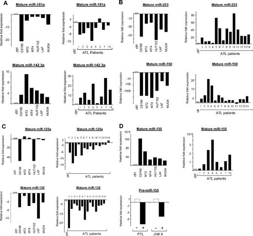 Figure 2. Real-time quantification of mature miRNA in HTLV-I cell lines and ex vivo ATL samples. (A-D) TaqMan real-time RT-PCR from HTLV-I–transformed cells (C8166, MT2, MT4, and HUT102) and immortalized cells (LAF and MU04) in vitro and ATL tumor cells ex vivo. The TaqMan probes that were used ensure accurate discrimination between miRNAs that may differ by a single nucleotide. Mature miRNAs were analyzed because maturation of pri-miRNA is subject to posttranscriptional regulations. The threshold cycle (CT) is defined as the fractional cycle number at which the fluorescence passes the fixed threshold. TaqMan CT values are used to measure the fold change. ATL samples and HTLV-I cell lines were compared with peripheral blood mononuclear cells (PBMCs) and purified CD4 T cells as controls. miR-24 was used as the internal control, because of its constitutive expression among ATL samples, control T cells, and HTLV-I cell lines. These experiments were performed by Asuragen (Austin, TX). All primers and probes were tested and validated by Asuragen. Statistical analysis is provided in Document S1. For panel D, MT4 cells were treated overnight with either 6 μM parthenolide (PTL) or 90 μM JNK II. Control cells were treated with DMSO. SYBR green real-time PCR was performed for pre-miR-155 expression (F: 5′-CTGTTAATGCTAATCGTGATAG-3′ and R: 5′-AATGCTAATATGTAGGAGTCAG-3′) with GAPDH (F: 5′-GAAGGTGAAGGTCGGAGTC-3′ and R: 5′-GAAGATGGTGATGGGATTTC-3′) as an internal control. All experiments were performed in triplicate.