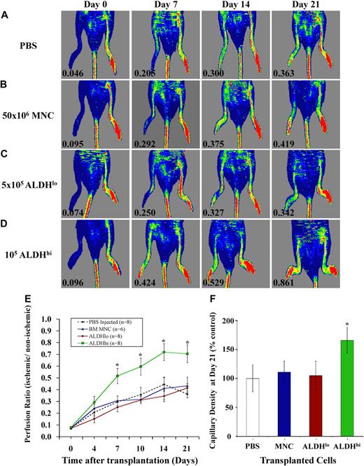 Figure 2. Transplantation of BM-derived ALDHhi cells improved perfusion and capillary density in ischemic limbs. (A-D) Representative LDPI after right femoral artery ligation and tail vein injection of PBS (n = 8), 50 × 106 BM MNCs (n = 6), 5 × 105 ALDHlo (n = 8), or 1 to 2 × 105 ALDHhi cells (n = 8) monitored weekly for 21 days. Numbers in the lower left of each LDPI image indicate PR of the ischemic versus the nonischemic limb. (E) Summary of PRs for all mice transplanted as indicated in panels A through D. Transplantation of BM ALDHhi cells augmented perfusion in ischemic limbs from 7 to 21 days after transplantation (*P < .05). (F) Capillary density at days 21 to 28 was increased in mice transplanted with ALDHhi cells (*P < .05). All micrographs were viewed with an Olympus (Hamburg, Germany) BX50 microcoscope using air lenses and betaglucuronidase and hematoxylin stains. All images were taken with a Hitachi HV-F2S CCD camera using Northern Eclipse version 7.0 software. The following numeric aperture (NA) air objectives were used: panels C and F, 10×/0.30; panels E and G, 20×/0.50.