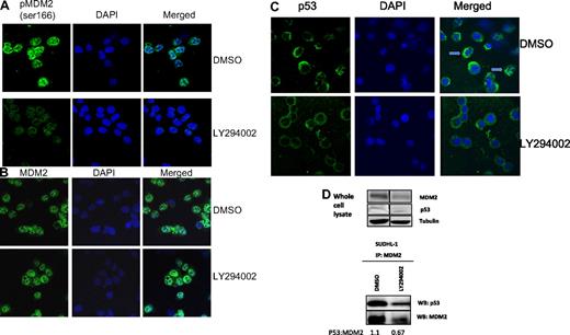 Figure 2. Phosphorylated MDM2 resides mainly in the nucleus. SUDHL-1 cells were treated with either DMSO control or LY294002 (20 μM) for 24 hours, after which cells were prepared as cytospins and stained with fluorescently labeled antibodies against p(ser166)MDM2 and DAPI (A) or MDM2 and DAPI (B). SUDHL-1 cytospins were also analyzed for p53 expression and localization 24 hours after inhibitor treatment (C). Arrows point to cells in which p53 appears to be sequestered to cytoskeletal structures. MDM2:p53 complex formation in response to 24 hours treatment with 20 μM LY294002; vertical lines have been inserted to indicate a repositioned gel lane (D). Numbers represent the ratio of p53:MDM2 protein in arbitrary units after densitometric analysis. Equal quantities of cell lysate were entered into the IPs.