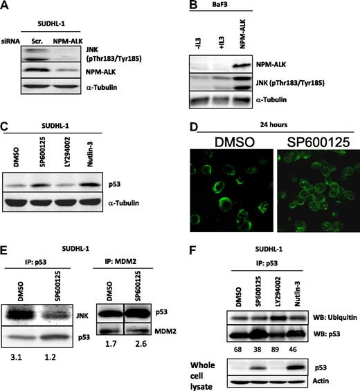 Figure 4. JNK destabilizes p53 in NPM-ALK–expressing cells. NPM-ALK phosphorylates JNK on Thr183/Tyr185 as demonstrated by down-regulation of NPM-ALK after transfection of SUDHL-1 cells with siRNA targeted to ALK for 48 hours (A). Likewise, NPM-ALK–expressing BaF3 cells express JNK in a phosphorylated form (B). Inhibition of JNK activity with the ATP competitive inhibitor SP600125 for 48 hours at a dose of 20 μM results in an increase in p53 expression in SUDHL-1 cells (C). Confocal microscopy examining p53 cellular location in SUDHL-1 cells treated with 20 μM SP600125 for 24 hours (D). IP of p53 or MDM2 protein after treatment of SUDHL-1 cells with SP600125 for 48 hours at 20 μM. Numbers represent ratios of arbitrary units after densitometric analysis of JNK and p53 protein levels; vertical lines have been inserted to indicate a repositioned gel lane (E). IP for p53 followed by Western blot analysis for ubiquitinated p53 using an anti-ubiquitin antibody. Numbers represent the percentage of p53 protein that is ubiquitinated as determined after densitometric analysis of protein levels (F).