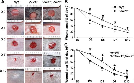 Figure 1. Wound closure of full-thickness wounds is delayed in Vav3−/− and Vav1−/−/Vav3−/− mice. (A) Representative macroscopic aspects of wounds from Vav3−/−, Vav1−/−/Vav3−/− and WT mice at different healing stages. (B,C) Statistical analysis of 24 wound areas quantified at days 0, 3, 5, 7 and 10 after wounding expressed as percentage of the initial (day 0) wound size for WT, Vav3−/− and Vav1−/−/Vav3−/− mice. Results given as mean ± SD (n = 6) reflect 1 of 3 independent experiments. *P < .05 by Mann-Whitney test.
