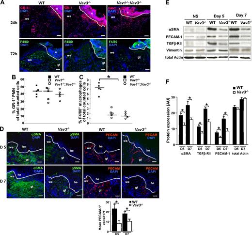Figure 2. Impaired recruitment of Mφ, but not of PMN, and reduced numbers of myofibroblasts and blood vessels at the wound sites of Vav3−/− mice. (A) GR-1+ PMN (red; top panel) and F4/80+ Mφ (green; bottom panel) recruitment to wound sites assessed by immunostaining of cryosections from Vav3−/−, Vav1−/−/Vav3−/− and WT mice. Quantification of GR-1+ PMN recruitment at 24 hours after wounding (B) and F4/80+ Mφ recruitment at 72 hours after wounding (C) by FACS analysis of wound cells isolated by enzymatic disruption from wound tissue. Results given as scatter plots. Bars indicate the median (n = 5). *P < .05 by Student t test. (D) Granulation tissue formation in 5 and 7 days old WT and Vav3−/− wounds assessed by immunostaining with myofibroblasts-specific αSMA (green) and endothelial cell–specific PECAM-1 (red). Cell nuclei are counterstained with DAPI (blue). Original magnification ×20, scale bar indicates 200μm; e, eschar, he, hyperproliferative epidermis; we, wound edge, gt, granulation tissue. Quantification of PECAM-1+ cells in 10 high-power fields (HPFs) of 5- and 7-day-old wounds of 4 Vav3−/− and WT mice. Data are given as mean ± SD numbers of PECAM-1+ cells counted per HPF. *P < .05 by Student t test. (E) Western blot analysis of snap-frozen nonwounded normal skin (NS) and of wound tissue at days 5 and 7 equilibrated to total actin and vimentin levels to measure expression of αSMA, TGFβ-RII and PECAM-1. αSMA, TGFβ-RII, PECAM-1, actin, and vimentin are expressed at identical levels in WT and Vav3−/− nonwounded skin, excluding that these molecules are globally down-regulated in Vav3−/− mice. (F) Semiquantitative balance analysis of immunoblots performed by densitometry of digitized Western blots. Data are given as mean ± SD. *P < .05 by Student t test.