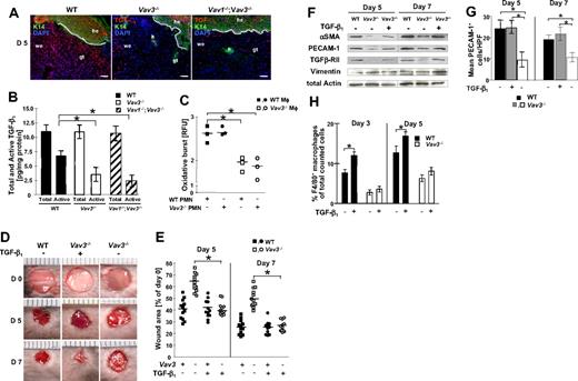 Figure 3. Reduced release of active TGF-β1 in the wound margins is causal for the wound healing defect of Vav3−/− and Vav1−/−/Vav3−/− mice. (A) Immunostaining of 5-day-old wounds from Vav3−/−, Vav1−/−/Vav3−/− and WT mice showing TGF-β1 (red) localization throughout the K14+ epidermis (green) and the wound tissue. Blue staining indicates nuclear staining with DAPI. Original magnification ×20, scale bar indicates 200μm; he, hyperproliferative epidermis; we, wound edge, gt, granulation tissue, h, hair follicle. (B) Quantitative evaluation of total and active TGF-β1 release from 5 days old Vav3−/−, Vav1−/−/Vav3−/− and WT wound lysates by specific ELISA. Results representative of 2 independent experiments are expressed as mean ± SD (n = 4). *P < .05 by Student t test. (C) Oxidative burst of WT and Vav3−/− Mφ upon phagocytosis of apoptotic WT or Vav3−/− PMN measured at 3 hours and expressed as the increase in fluorescence intensity of oxidized carboxy H2DCFDA. Data representative for at least 2 different experiments is given in RFU (relative fluorescence units) as scatter plot. Each symbol represents triplicate measurements, Mφ derived from 3 different mice of each genotype (n = 3). Bars indicate medians. *P < .05 by Student t test. (D) Representative macroscopic pictures of wounds derived from WT and Vav3−/− mice at days 5 and 7 after wounding and repetitive injection with a physiologic concentration of rhTGF-β1 (TGF-β1+) or of NaCl (TGF-β1−). (E) Statistical analysis of 16 wound areas expressed as percentage of the initial (day 0) wound size. Results presented as scatter plots. Bars indicate medians of each cohort (n = 4). *P < .05 by Mann-Whitney test. (F) Western blot analysis of snap-frozen wound tissue equilibrated to total actin and vimentin levels to assess expression levels of αSMA, TGFβ-RII and PECAM-1 in wound margins of different genotypes at different time points after injection of either rhTGF-β1 (TGF-β1+) or of NaCl (TGF-β1-). (G) Quantification of PECAM-1+ cells in 10 high power fields (HPF) of 5- and 7-day-old wounds of WT, Vav3−/− and TGF-β1–treated Vav3−/− mice. Data are given as mean ± SD numbers of PECAM-1+ cells counted per HPF. *P < .05 by Student t test. (H) Recruitment of F4/80+ Mφ assessed by FACS analysis of cells isolated by enzymatic disruption of 3- and 5-day-old wounds. Results given as scatter plots. Bars indicate the median (n = 4). *P < .05 by Student t test.