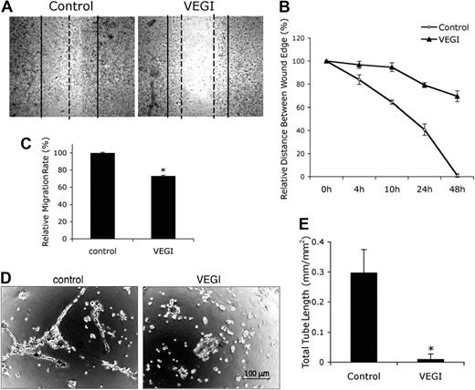 Figure 3. VEGI inhibits EPC migration and capillary-like tube formation. (A) Phase-contrast microscopic images of cell migration in a wound-healing assay (4× objective lens). EPCs cultured for 10 days in the absence or presence of VEGI were allowed to migrate for 48 hours after a strip of cells were removed from the center of the monolayer formed by the cells. Solid line represents wound edge; dashed line, front edge of migrating cells. (B) Relative distance from the wound edge to the front edge of cell migration measured at various intervals. (C) Relative rate of EPCs cultured for 7 days in the absence or presence of VEGI migrating in a transwell assay. After 8 hours after the seeding of the cells on the transwell chamber, migrated cells were visualized with a dye (CyQunat GR) and counted. (D) Phase-contrast microscopic images of the formation of capillary-like structures by EPCs on Matrigel. EPCs cultured for 2 weeks in the absence or presence of VEGI were placed on Matrigel, and the images were captured within 24 hours. (E) Measurement of the total length of the capillary-like tubes. Values are mean ± SE of 3 independent experiments. *P < .05.