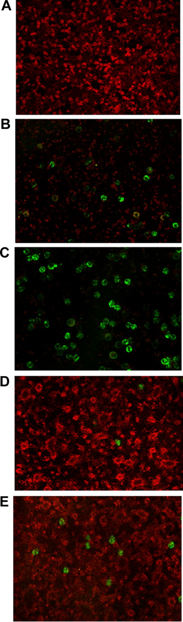 Figure 8. Requirements of P-selectin and phosphatidylserine for the clearance of activated platelets. Glass-adhered platelets were activated with thrombin (0.5 U/mL) for 2 minutes, washed, and incubated either alone (A) or in the presence of purified autologous neutrophils for 2 minutes (B) or 5 minutes (C-E). (D) Platelets were treated with mAb anti–P-selectin before addition of neutrophils. (E) Platelets were treated with recombinant annexin A5 before addition of neutrophils. Glass-adhered, activated platelets were revealed by confocal microscopy after staining with antiplatelet glycoprotein Ib mAbs (red) and neutrophils after staining with the anti-CD66b mAb (green).