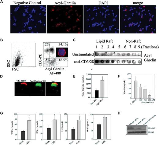 Figure 1. Ghrelin expression and function in T cells. (A) The purified human T cells were stained with incubated with control IgG and did not show nonspecific binding, whereas acylated ghrelin was found to be expressed in T cells. Nuclei are labeled with DAPI and acyl ghrelin was visualized by anti–guinea pig acyl ghrelin antibody conjugated to Alexa Fluor-594. Greater than 50% of the cells are labeled for acyl ghrelin (red). Given that these images are acquired using an epifluorescent microscope, certain dim acyl ghrelinlo cells appear negative in the merge with DAPI. Thus, in the merge image distribution may appear less that 50%. The FACS analysis of peripheral blood mononuclear cells (PBMCs) for acylated ghrelin (B) allows the laser to pick MFIs of varying ghrelin expression (including weakly stained cells) on T cells. Images were acquired by Spot Advanced software on a Zeiss Axiovert S100 Microscope under 100× objective (Carl Zeiss, Thornwood, NY). (B) The human PBMCs were double labeled with anti-CD3 antibody conjugated to phycoerythrin and stained with acyl ghrelin conjugated to Alexa Fluor-488 and analyzed on FACS Calibur (Becton Dickinson, San Jose, CA). A representative plot from duplicate runs of 3 healthy donors is shown. Control antibody staining was not significant in any donor tested. Here, 46% of the PBMCs labeled positive for CD3 and 34% of the PBMCs expressed CD3+ and acylated ghrelin indicating that greater than 70% of the T cells express acylated ghrelin. Approximately 18% of the CD3− ghrelin-positive cells most likely represents B and natural killer (NK) cells and monocytes. (C) Primary human T cells were stimulated by plate-bound anti-CD3 and -CD28, and lipid raft fractions were analyzed for acyl ghrelin expression by dot blot analysis. (D) GM1+ lipid rafts in activated T cells were visualized by cholera toxin conjugated to Alexa Fluor-594; the activated human T cells display polarized expression of acyl ghrelin and colocalized with lipid raft. (E) The lipid raft and cytoplasmic fractions were pooled and equalized for protein, and ghrelin was analyzed using ELISA. (F) Ghrelin siRNA causes significant reduction in ghrelin production from primary human T cells. (G) Ghrelin knockdown in activated T cells increases proinflammatory cytokine secretion. We failed to observe any influence of the siRNA on T-cell proliferation or cell viability and thus we believe these variables have no influence on the cytokine inhibition observed (data not shown). (H) Total protein lysates from control and ghrelin siRNA–transfected cells were analyzed for phosphorylation of IkB. Control siRNA–transfected cells were treated with 100 ng/mL ghrelin for 5 minutes.