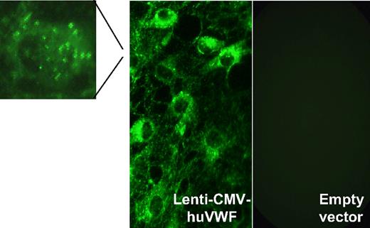 Figure 2. Expression of transgene-encoded VWF in VWD BOECs after lentiviral transduction. VWD BOECs were isolated from dogs with VWD type 3 and transduced with lentiviral vectors encoding full-length human VWF. VWF immunostaining revealed high concentrations of VWF present in both the cytoplasm and Weibel-Palade bodies (magnification) of transduced VWD BOECs (Lenti-CMV-huVWF) but not in VWD BOECs transduced with empty lentiviral particles (empty vector). Reprinted from De Meyer et al68 with permission.
