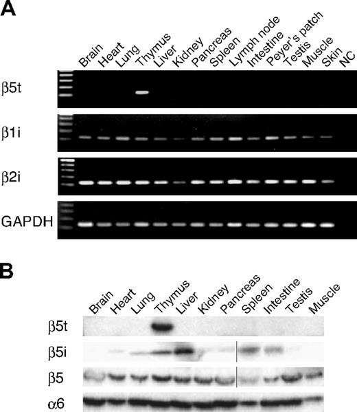 Figure 1. Human β5t is expressed specifically in the thymus. (A) RT-PCR analysis of β5t, β1i, and β2i expression in human tissues. NC indicates negative control. (B) Immunoblot analysis of human tissues with indicated Abs. Vertical lines have been inserted to indicate a repositioned gel lane.