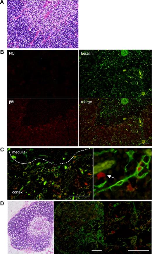Figure 2. Human β5t is expressed exclusively in the thymic cortex. (A) Hematoxylin and eosin (HE) staining of neonatal human thymic tissues. (B,C) Immunofluorescence staining of neonatal human thymic tissues. The medulla is identified by the presence of Hassall corpuscles and lower cell density than in the cortex. β5t-expressing cells are located only in the cortex, and most of the β5t-expressing cells in the cortex are keratin-positive cTECs. Magnified images of immunostaining (C) reveal that β5t is expressed in cTECs, but some β5t-expressing cells are not stained with the Ab for keratins (arrow). The staining patterns shown were representative of three neonatal thymic tissues. Negative control (NC) was stained with normal rabbit serum and mouse IgG1. (D) HE and immunofluorescence staining of adult human thymus. Expression of β5t is maintained in cTECs. The staining patterns shown were representative of five adult thymic tissues. Red represents β5t; green, keratin. Bar indicates 100 μM.